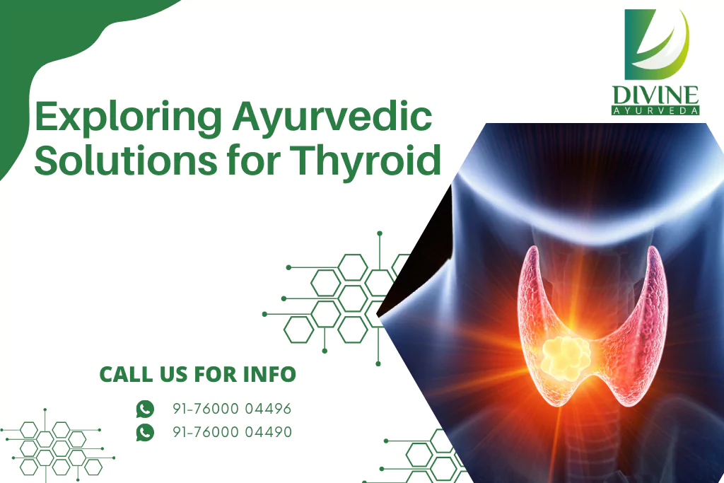 Exploring Ayurvedic Solutions for Thyroid